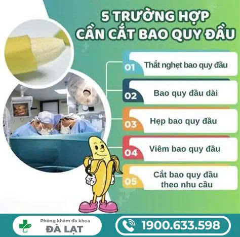Hình ảnh minh họa